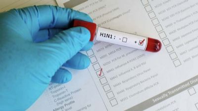 Secretaria Municipal de Sade emite alerta sobre Influenza
