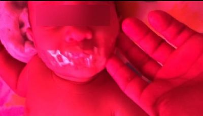 Beb de 6 meses que teve fita colada na boca  encaminhada para abrigo