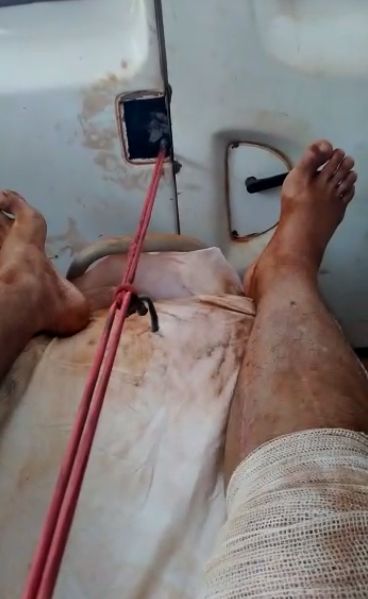 Vdeo | Morador de Aripuan  transportado em ambulncia com terra e porta quebrada