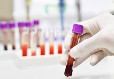 Brasil enfrenta escassez de testes para doenas como chikungunya e tuberculose