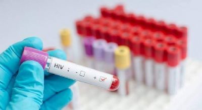 Ministrio estima que 135 mil brasileiros vivam com HIV sem saber