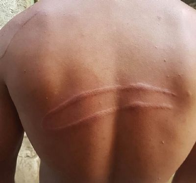 Homem  agredido por amigo com golpes de mangueira e socos no rosto