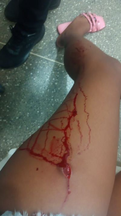 Aluna de 17 anos é esfaqueada durante briga com colega na frente de escola