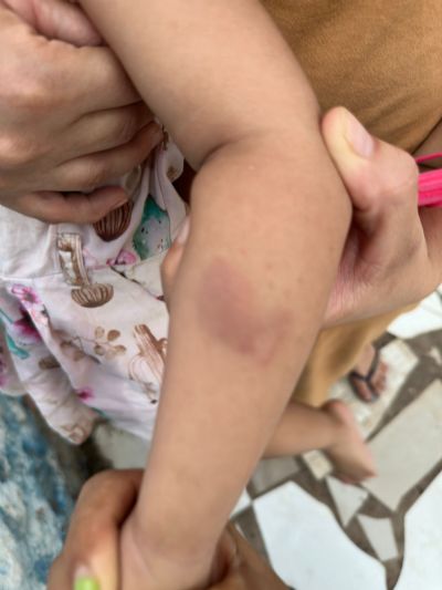 Me denuncia maus-tratos contra filha de 1 ano em Emeb de Cuiab