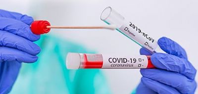 MT registrou 32 mortes e 1.244 novos casos de Covid-19 nas ltimas 24 horas