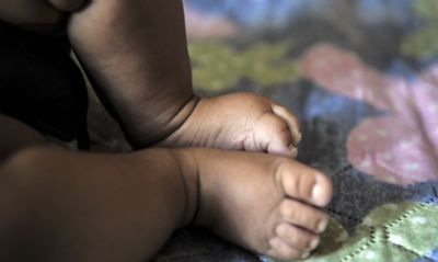 Cncer infantil: diagnstico precoce pode resultar na cura de at 80%