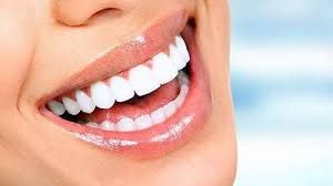 Clareamento dental: cuidado com as solues caseiras