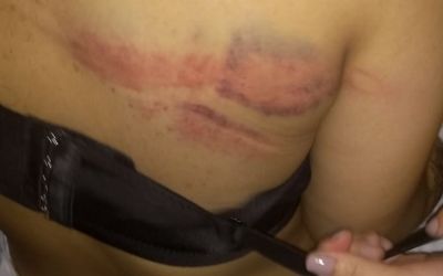 'Foi uma emboscada da polcia', diz me de adolescente ferida em Paraispolis; PM diz que suspeitos atiraram