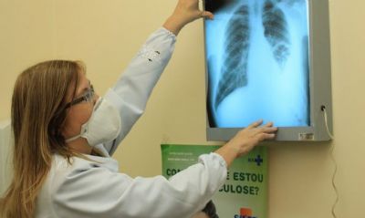 Brasil instala comit interministerial para eliminao da tuberculose