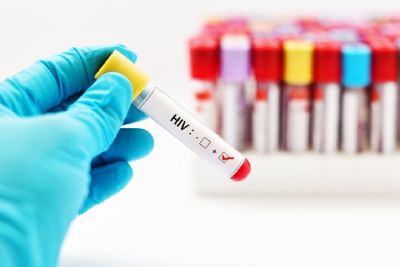 Hospital Geral realizar gratuitamente testes rpidos de HIV