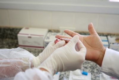 Ministrio inclui todos os adultos com HIV em grupo prioritrio da vacinao