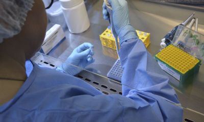 Universidade de Braslia e HUB iniciam teste de vacina contra covid-19
