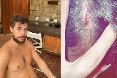 Ator Rafael Vitti sofre acidente ao surfar e mostra ferimentos nas redes